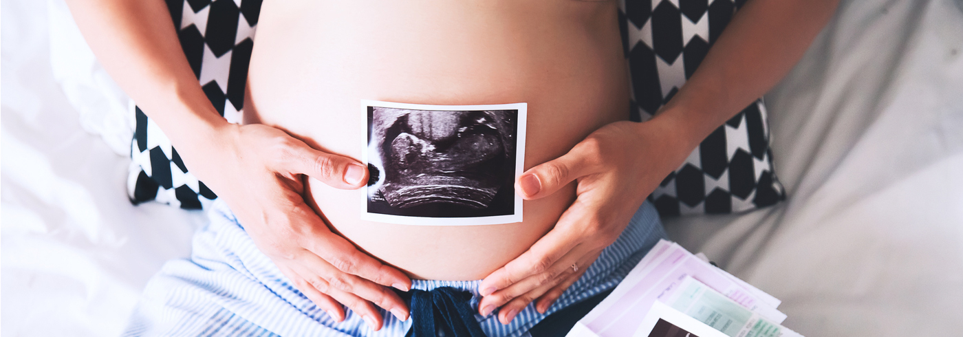 A woman with an ultrasound picture on her pregnant belly.