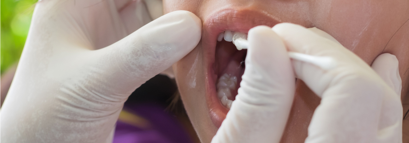 Registered dental hygienist applying fluoride treatment to patient.