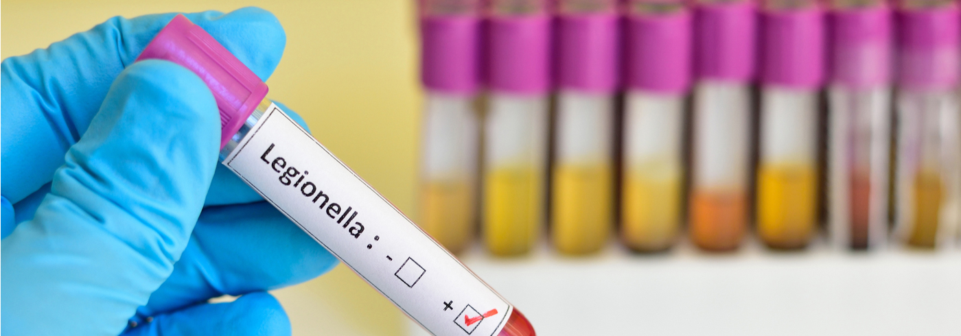 Gloved hand holding a lab vial labelled Legionella.